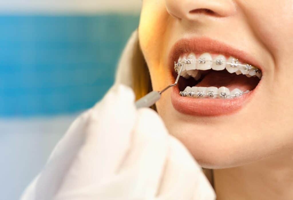 How to Choose the Right Orthodontist for Your Family