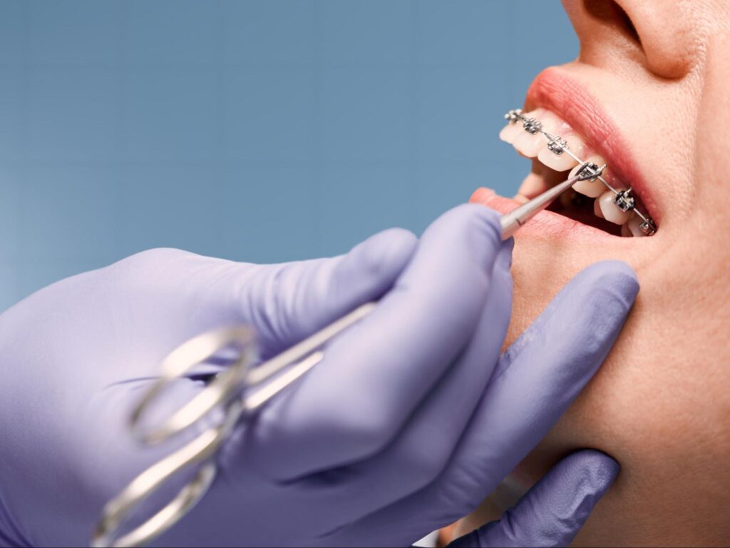 The Benefits of Same-Day Appointments & Braces